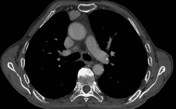 Informes urgentes / Radiología urgente